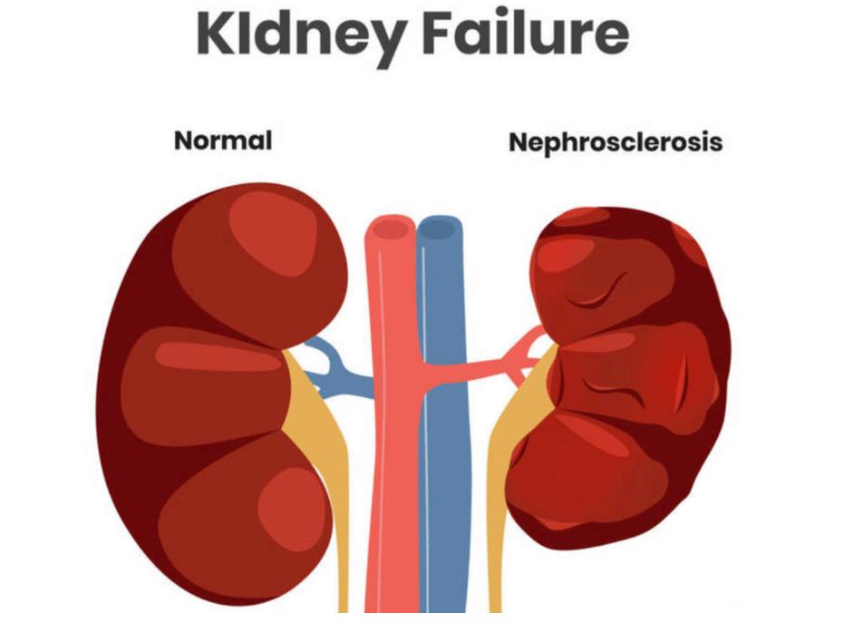 这3种药长期服用很伤胃,这三种药很伤肾提醒建议不要多用