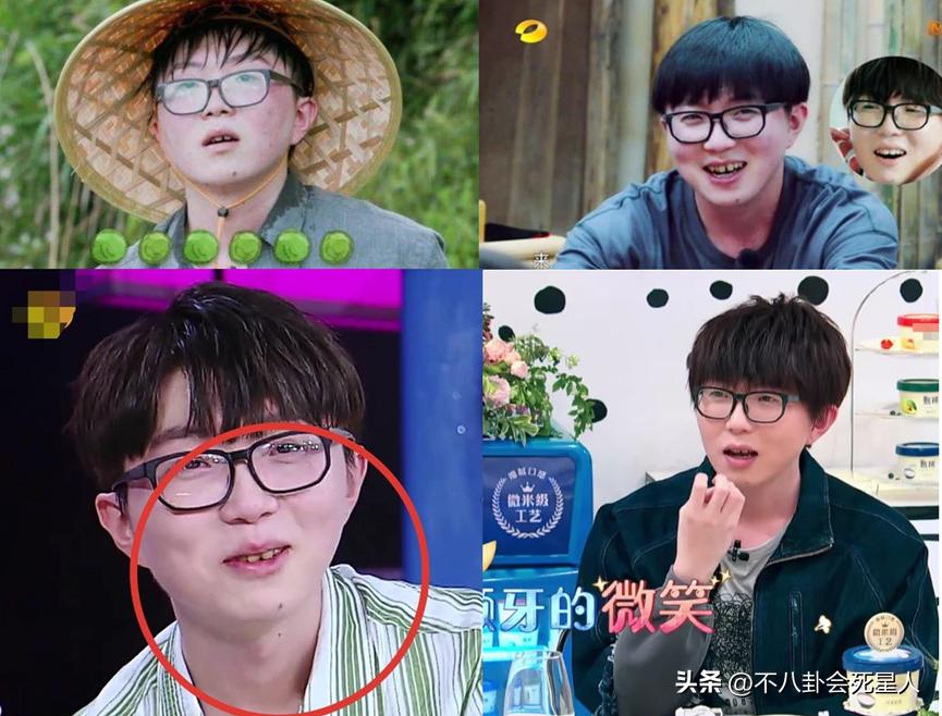 戴牙套是双刃剑：毛不易拯救一口烂牙，刘雯、肖战却变难看了