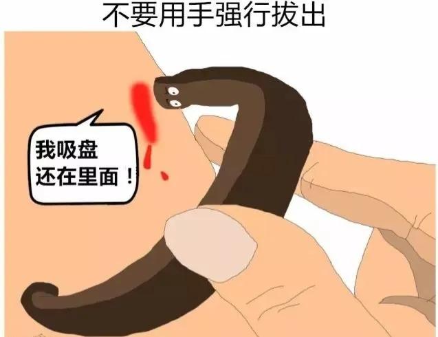 蚂蟥最怕的是食盐能瞬间将它榨干,蚂蟥吸血后会死吗