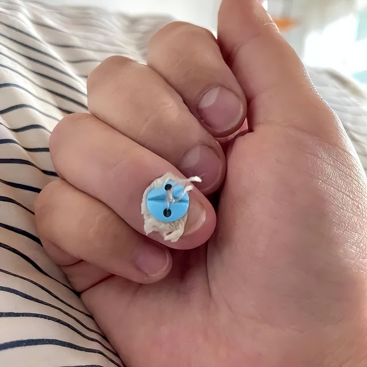 鳄鱼的屁股长这样啊…35张拍下奇怪东西的照片，网友看了都说好！