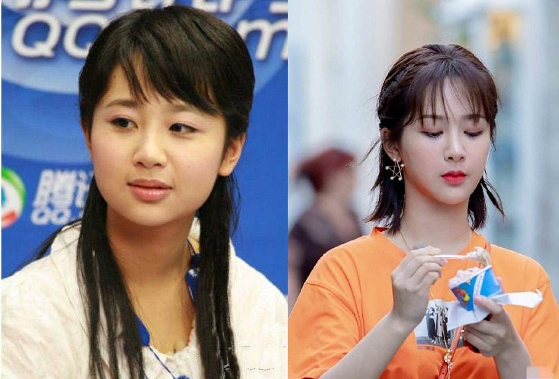 最近脸僵硬的女星,脸部变僵硬的女明星