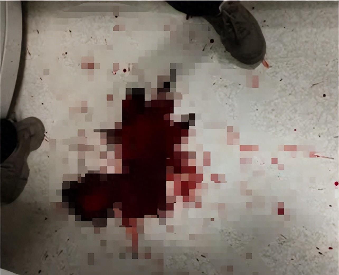 临终脱水、疼到痉挛，却被妻子强制插胃管，45岁丈夫呕出浓黑血液