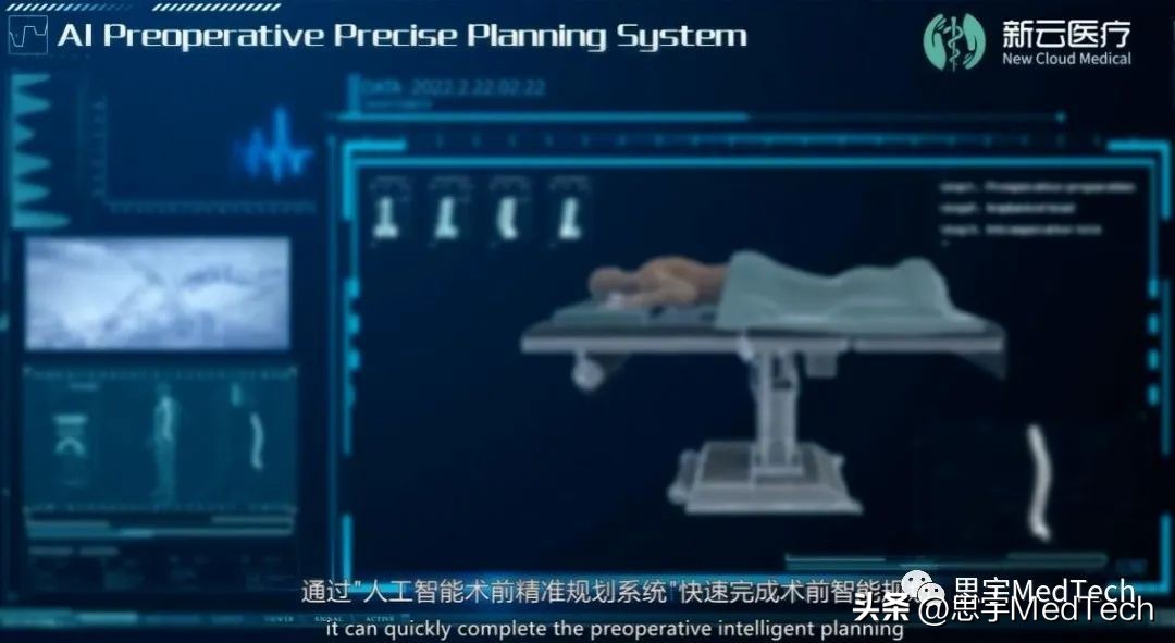 医疗器械公司奖励百万,微创医疗获1.5亿美元贷款