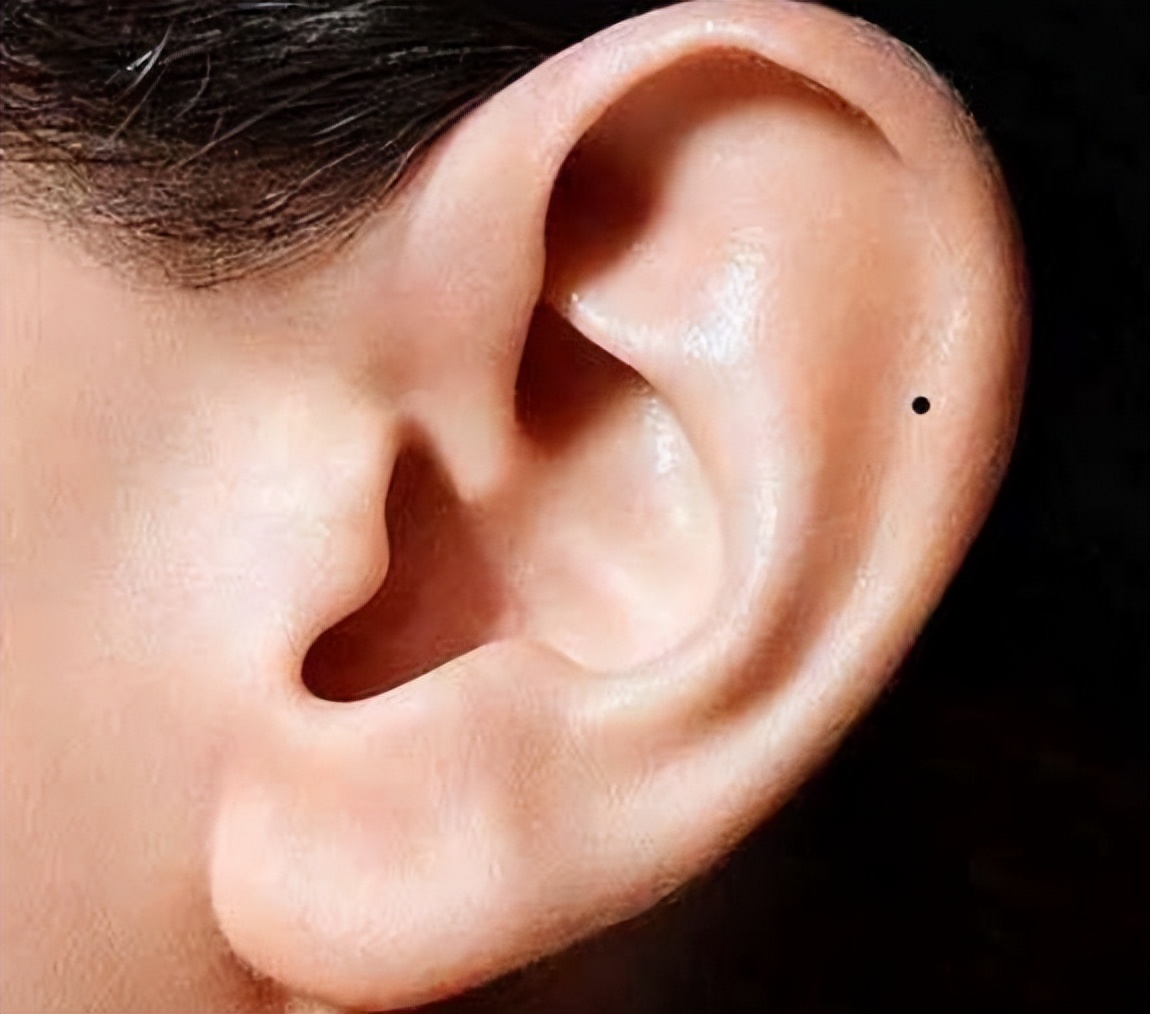 穷人耳富人耳有没有科学依据,穷人耳朵和富人耳朵有什么区别