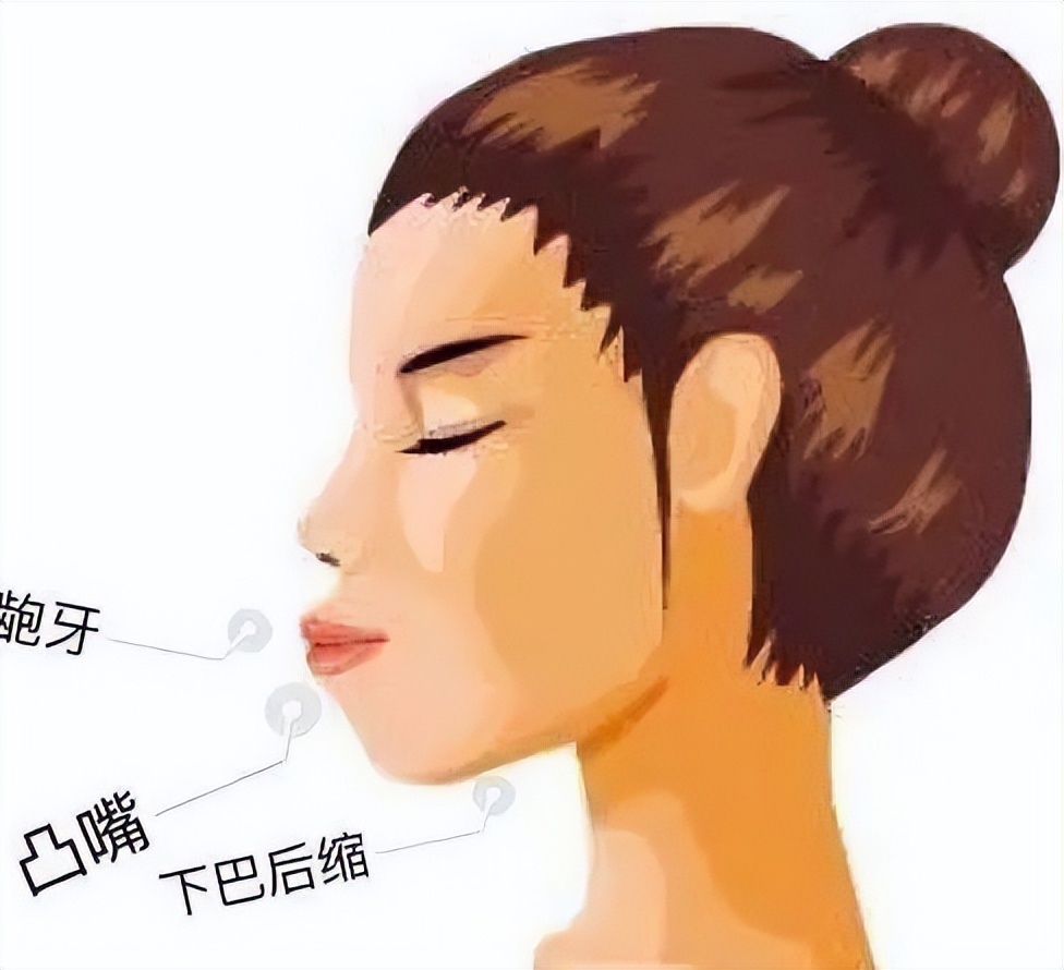 下颌线高好看还是下颌线低好看,下颌线和没有下颌线对比图