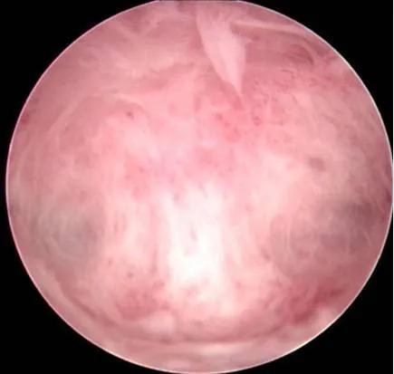 什么是宫腔镜？宫腔镜可以治疗哪些疾病？