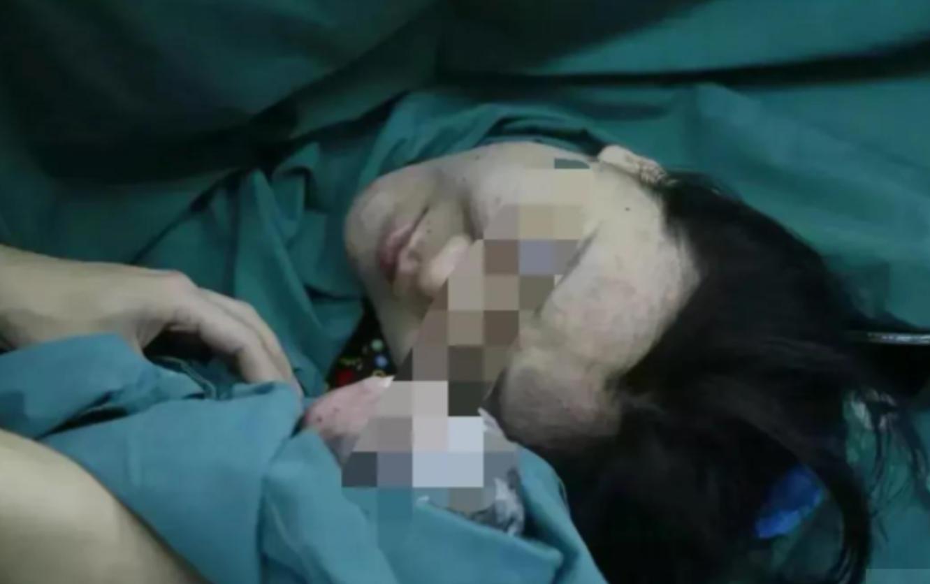 外婆的子宫孕育外孙！2015年，女子移植母亲子宫，4年后生下男婴