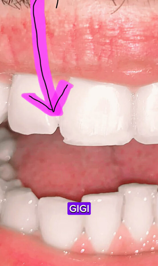 一名大爷用牙齿开椰子,男子用嘴开椰子惊呆网友