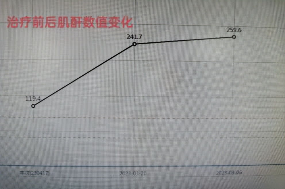 系统性红斑狼疮早发现好控制吗,系统性红斑狼疮治得好不