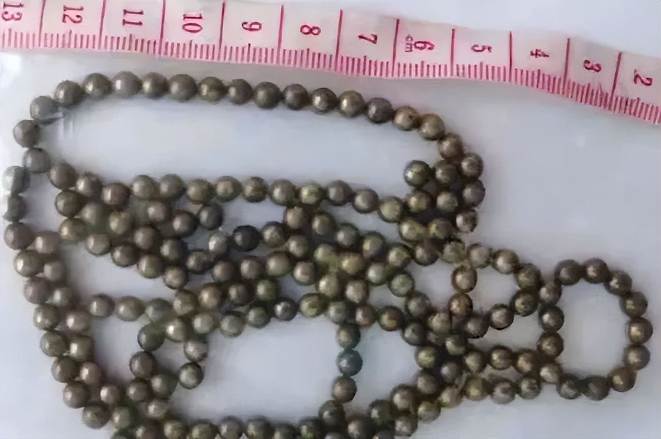 7岁女孩死亡体内却有异物,少女体内被埋神秘异物