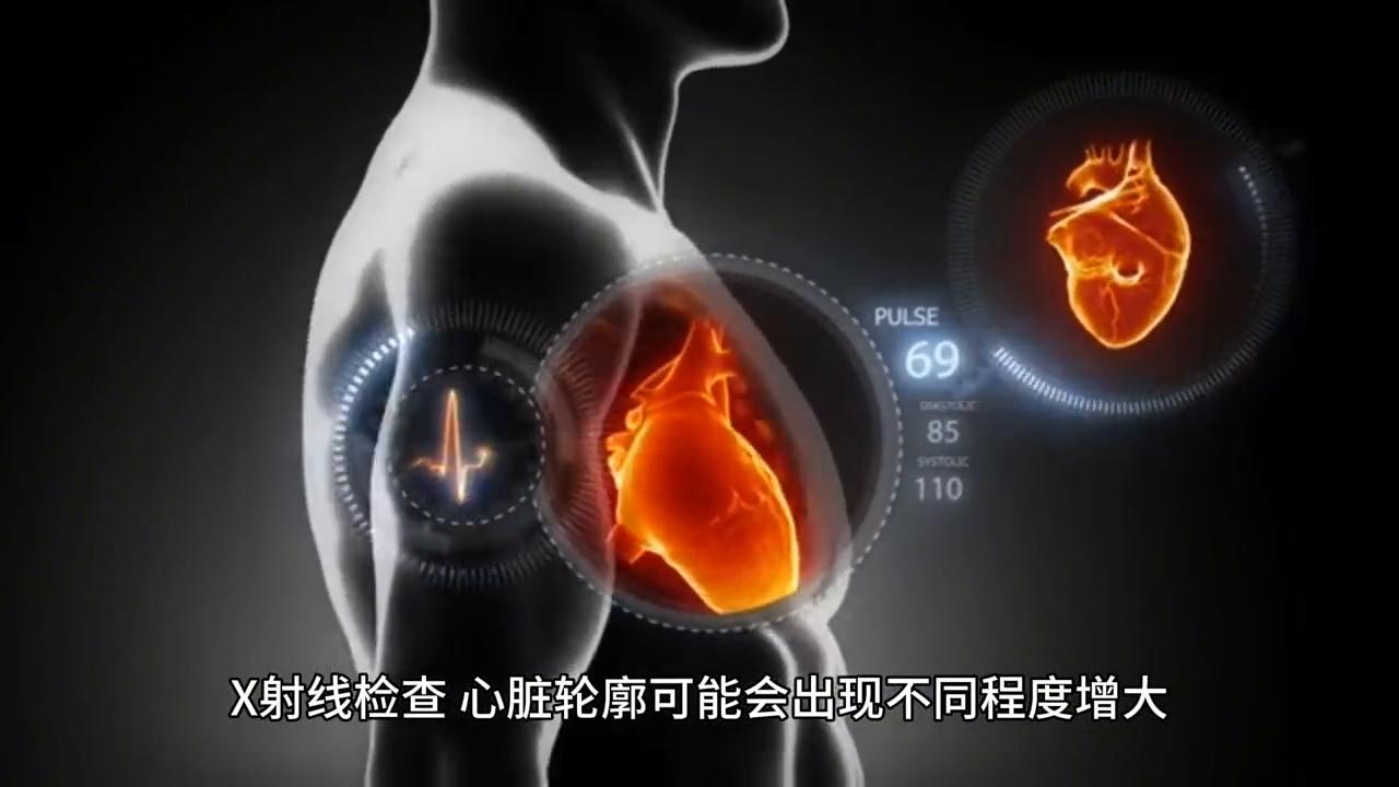 肥厚型心肌病猫,犬猫疾病诊疗视频