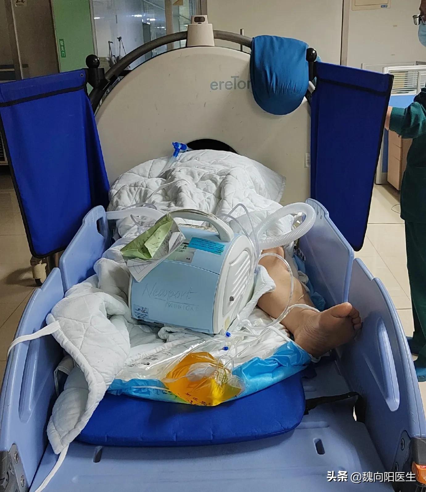 我的父亲大面积脑梗,我父亲脑梗3年后歪着坐在轮椅上