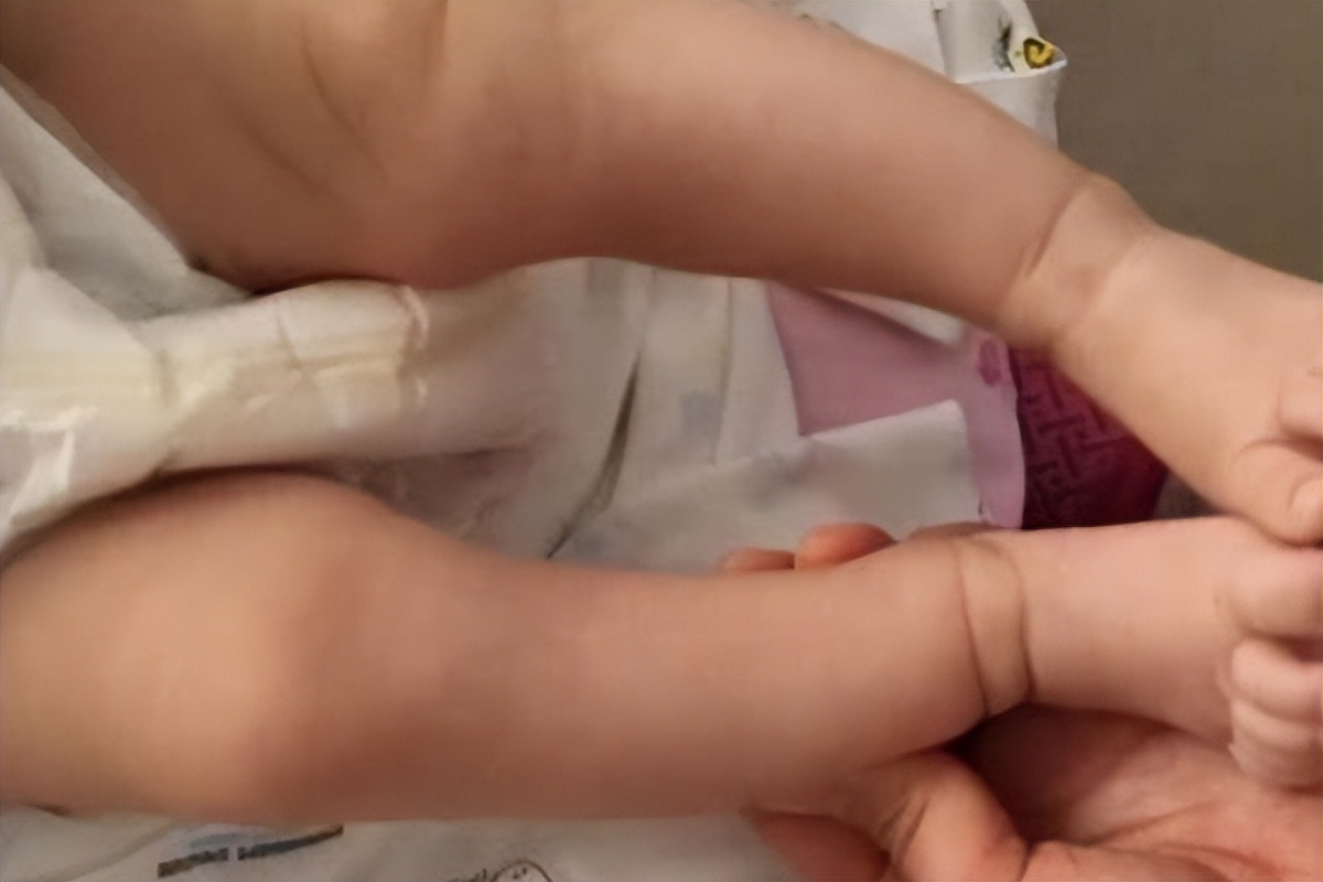 父母都不是o型腿孩子会是吗,家长有o型腿会遗传给宝宝不