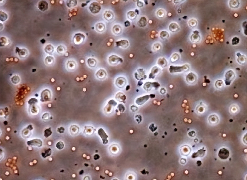 肿瘤患者蛋白粉和鸡蛋哪个好,癌症病人适合吃蛋白质粉