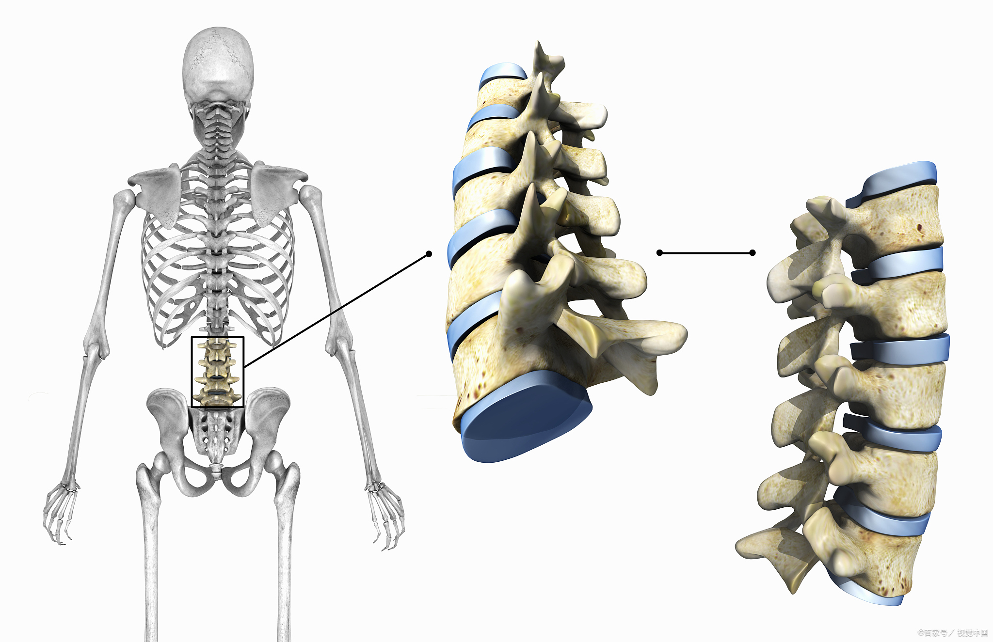 腰3-4椎间盘膨出最好的治疗方法,腰3-4椎间盘膨出怎么治