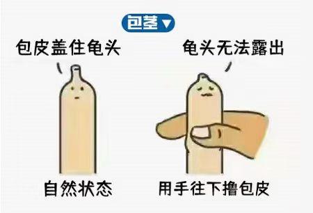 小儿包茎最佳手术年龄,关于儿童包茎手术新闻