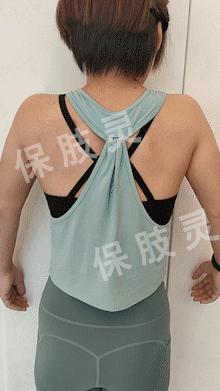 颈椎间盘突出压迫桡神经怎么恢复,颈椎间盘突出压迫手指麻怎么治疗