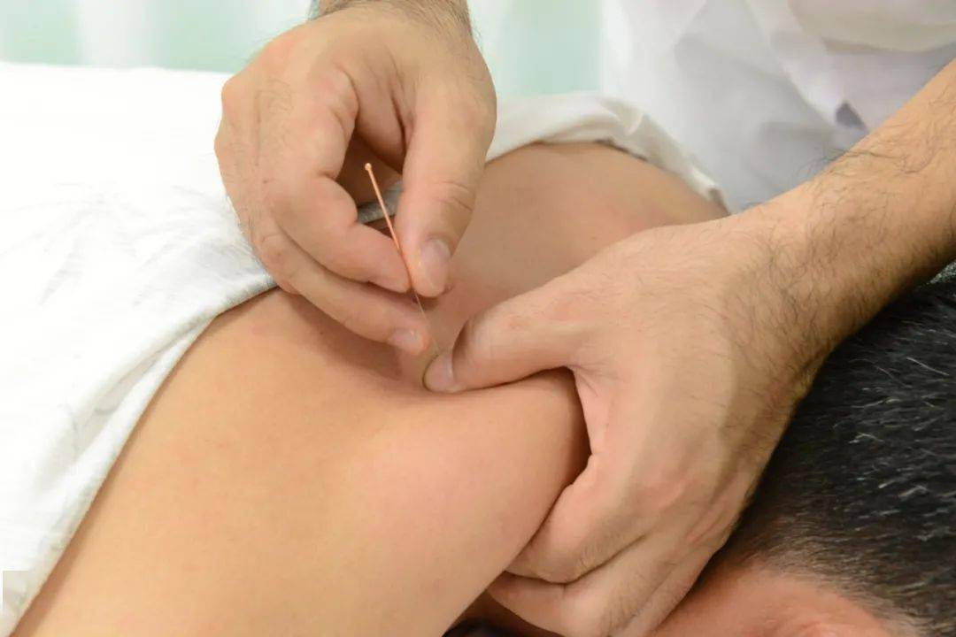 走进中医|运用中医岐黄针对中风后下肢痉挛症状的治疗