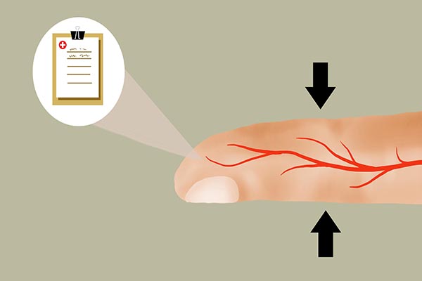 血糖高看脚能看出来吗,血糖高的人脚上有四种表现