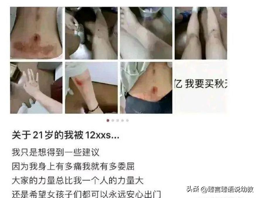 “儿童色情”画展，明目张胆的开办，这些人居心叵测赶紧彻查