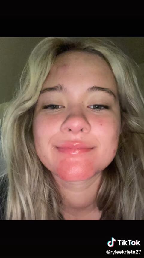 澳洲妹子和男友接吻,澳大利亚女子与男友接吻