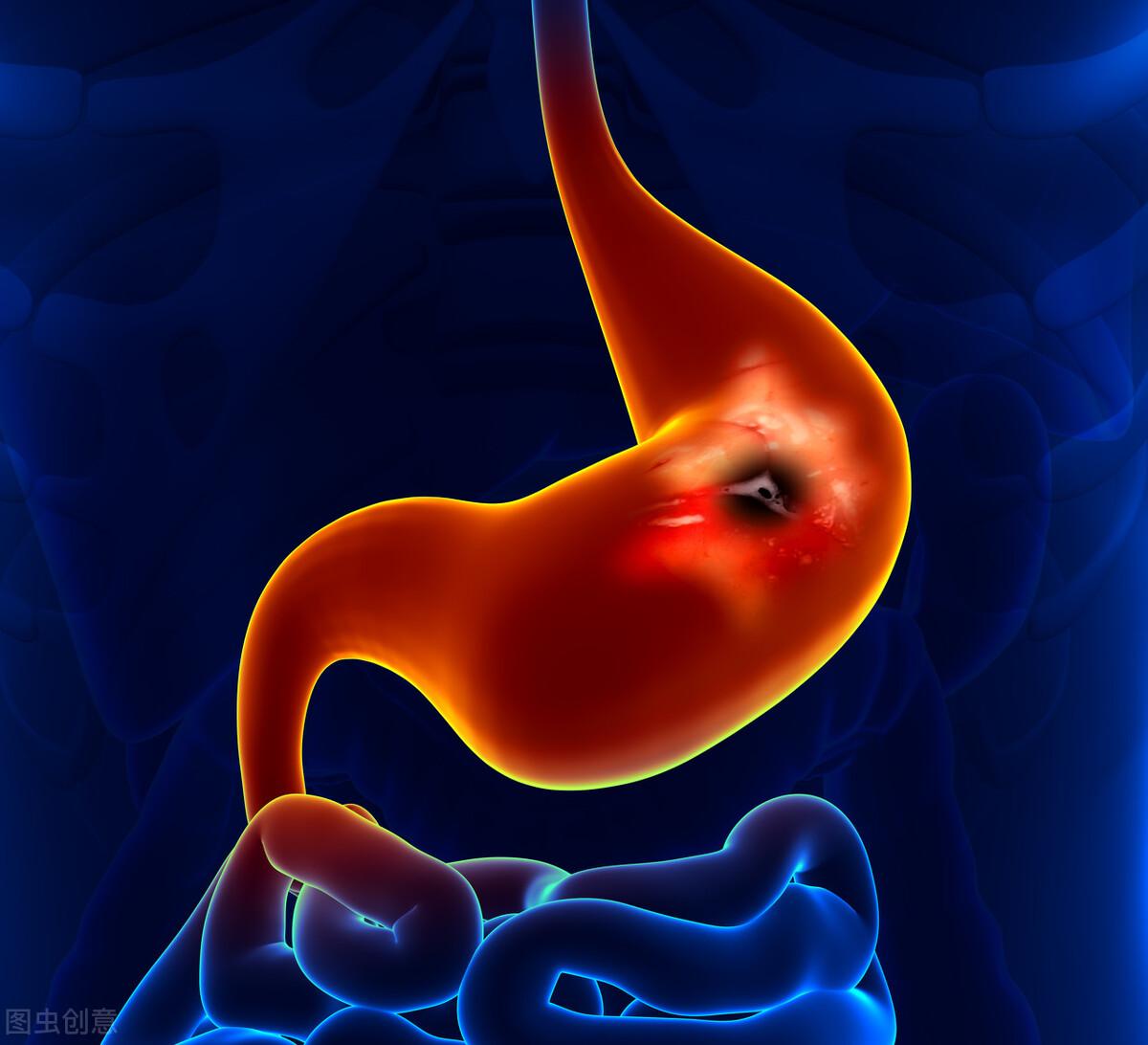 口苦口臭是幽门螺杆菌引起的吗,口臭是有幽门螺旋杆菌吃啥药