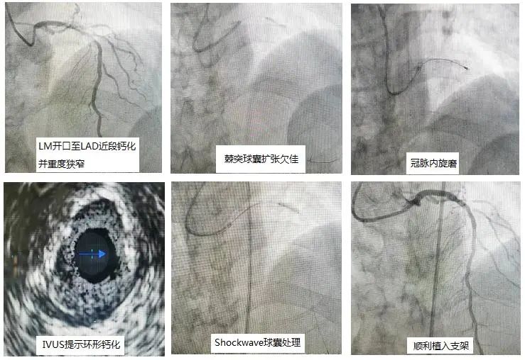 北京胸科医院心血管内科,北京胸科医院心脏中心医生