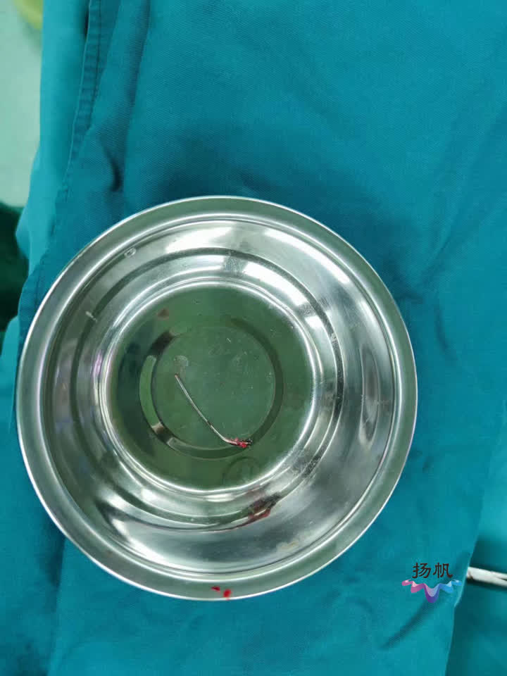 扎心了！气钉击中小伙心脏医生补心救命