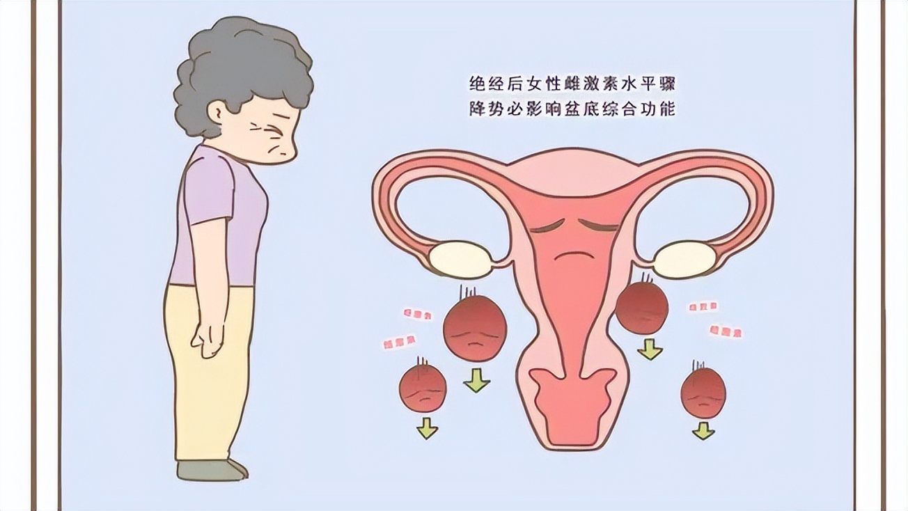 为什么女性绝经后，不愿过“夫妻生活”了？3个原因男女都要了解