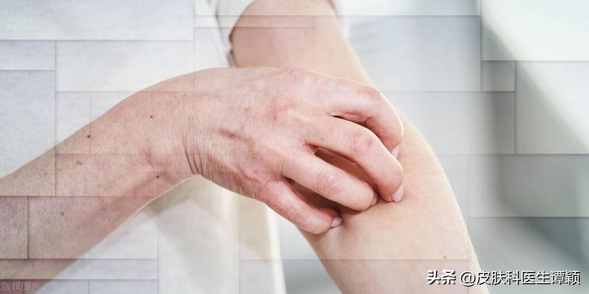 皮肤科医生与易过敏体质,免疫力下降导致皮肤过敏会自愈吗