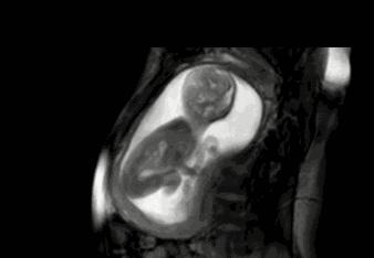 胎宝在肚子里都在干嘛,胎宝在肚子里一弹一弹的