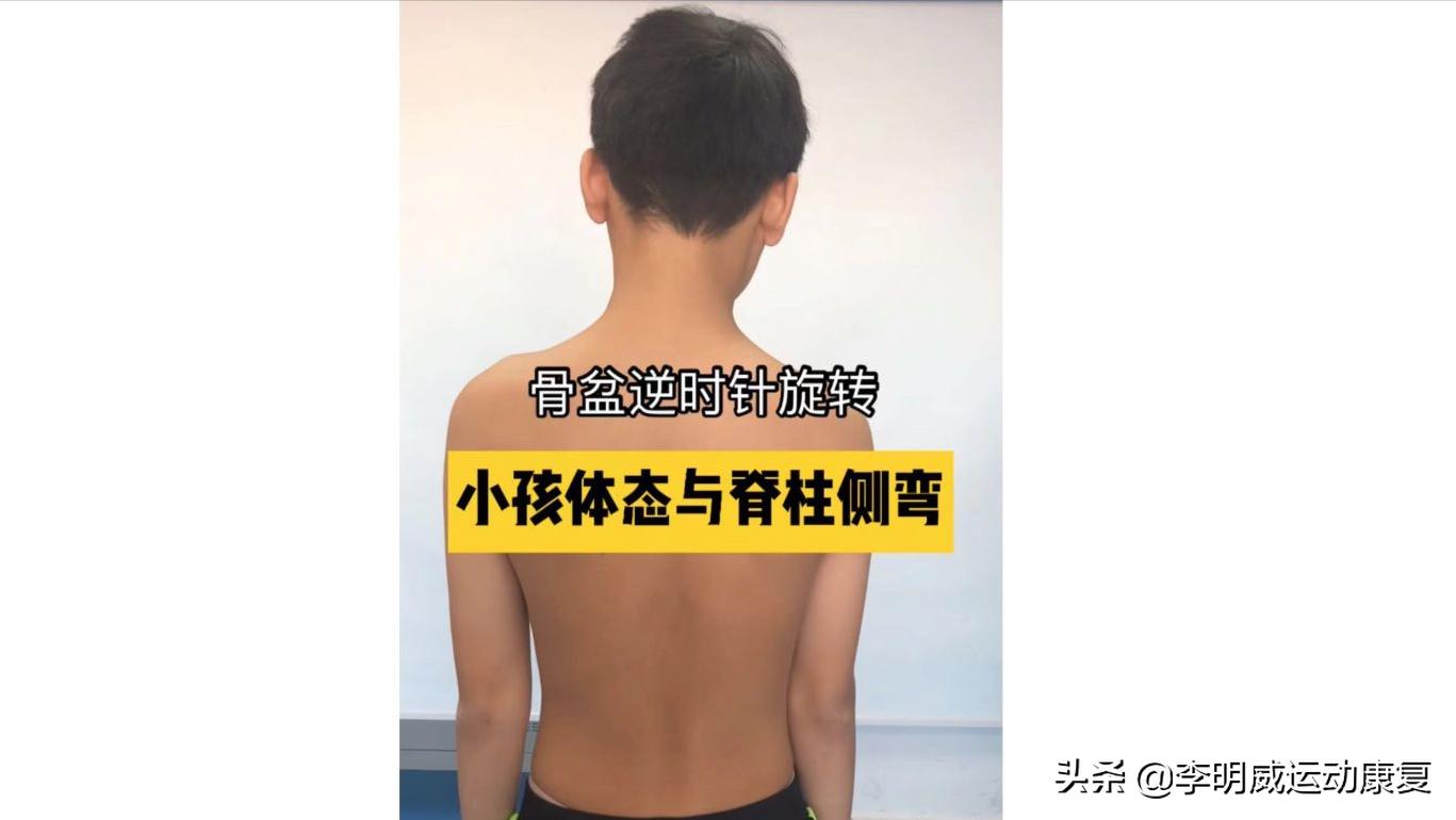 14岁男孩脊柱侧弯怎么训练,14岁女孩脊柱侧弯以后还会加重吗
