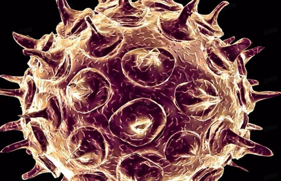 学校水痘爆发的防控措施,学校水痘感染防治要求