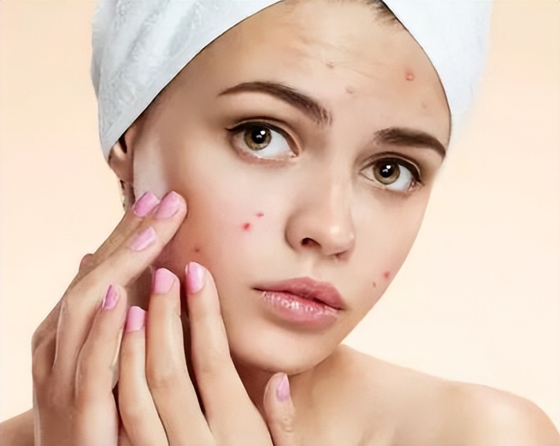 治疗痘印最有效的医美手段,脸部痘印中医能治疗嘛