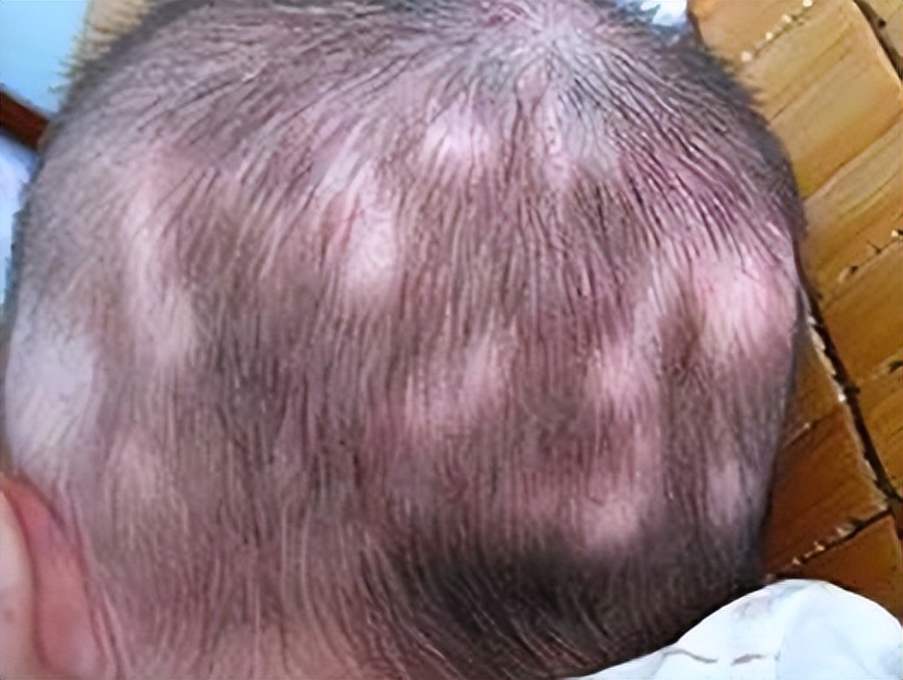 未满月的新生儿头发少还掉头发,宝宝头发稀少剃头发可以改善吗