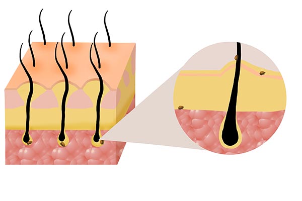 怎么解决头发出油的问题,怎样解决头发出油的问题