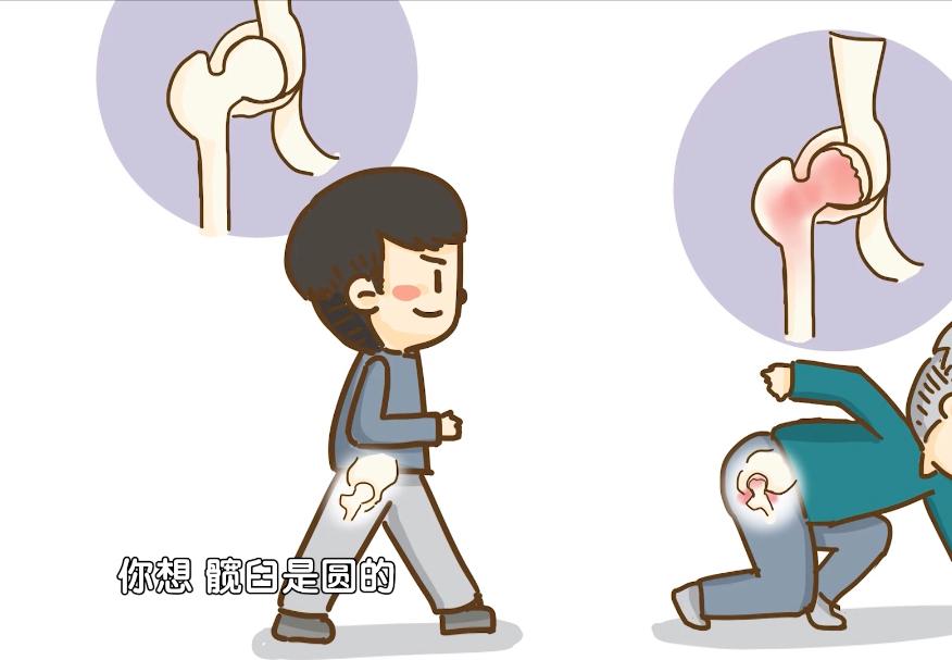 早期发现股骨头坏死能不能治,股骨头坏死如何防止病情加重