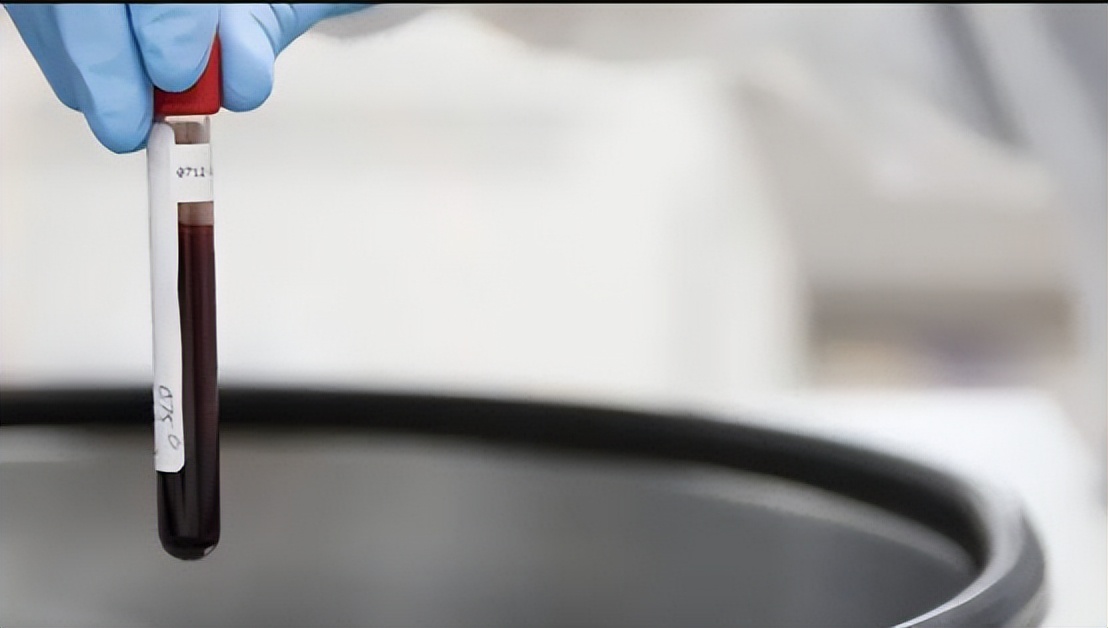 香港查获1500血液样本，疑与“寄血验子”有关，内地人为何要验子