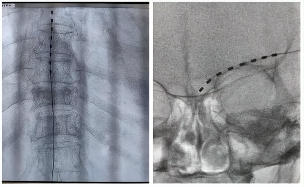 疼痛难忍最好的治疗方法,疼痛难忍的治疗