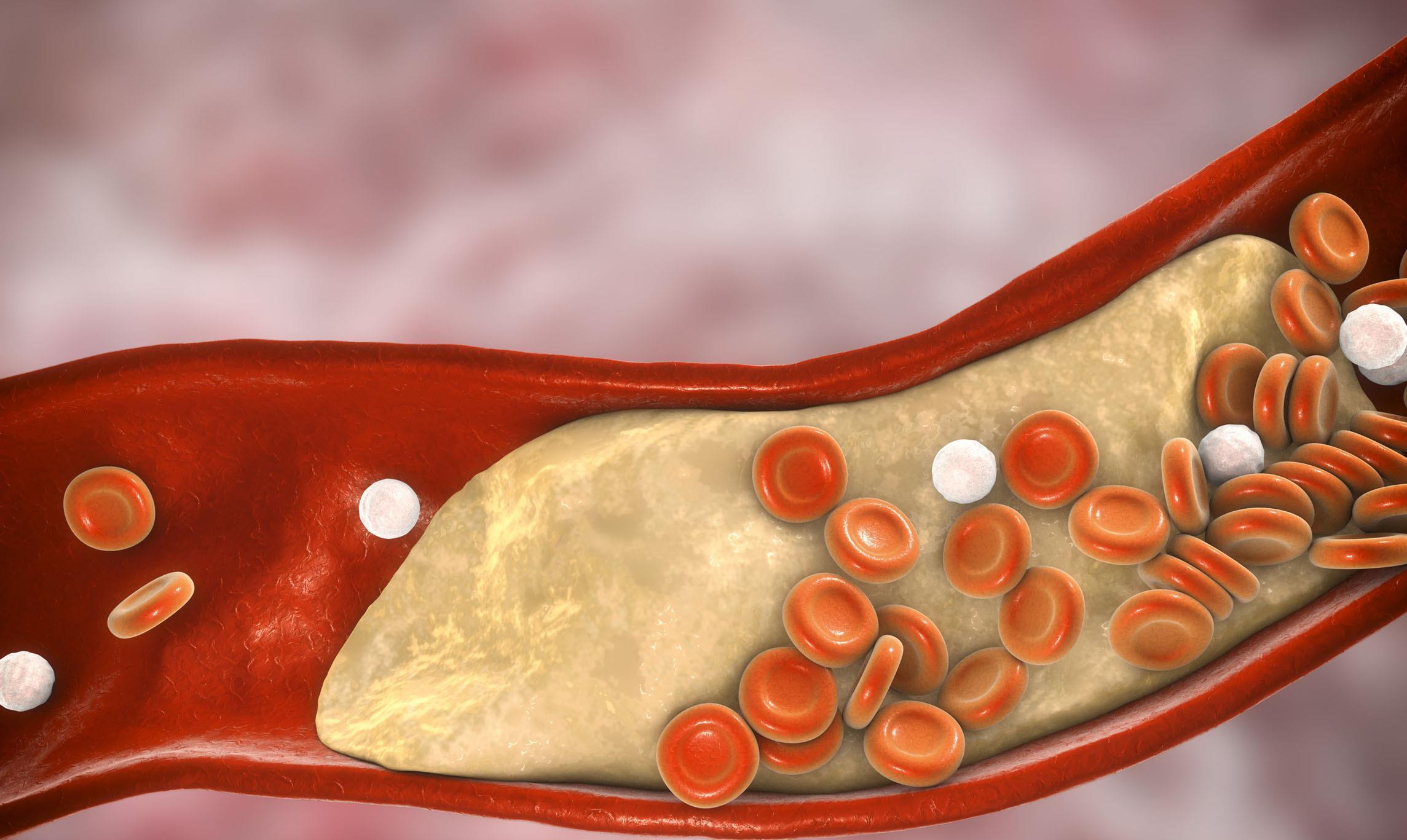 半年一针降脂药哪里可以打,进口降脂特效药
