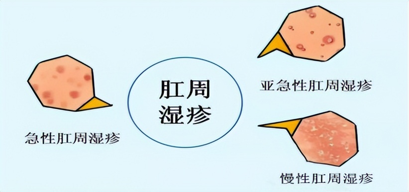 女性“事后”用纸巾擦到底好不好？要注意哪些问题？听听医生建议