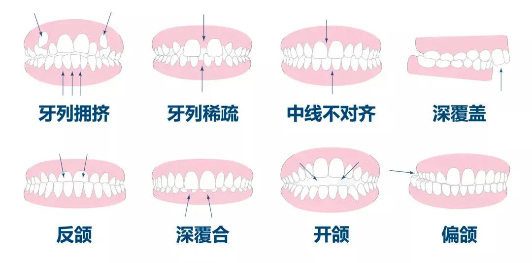 c罗是怎么整牙的,c罗的牙齿整过形吗