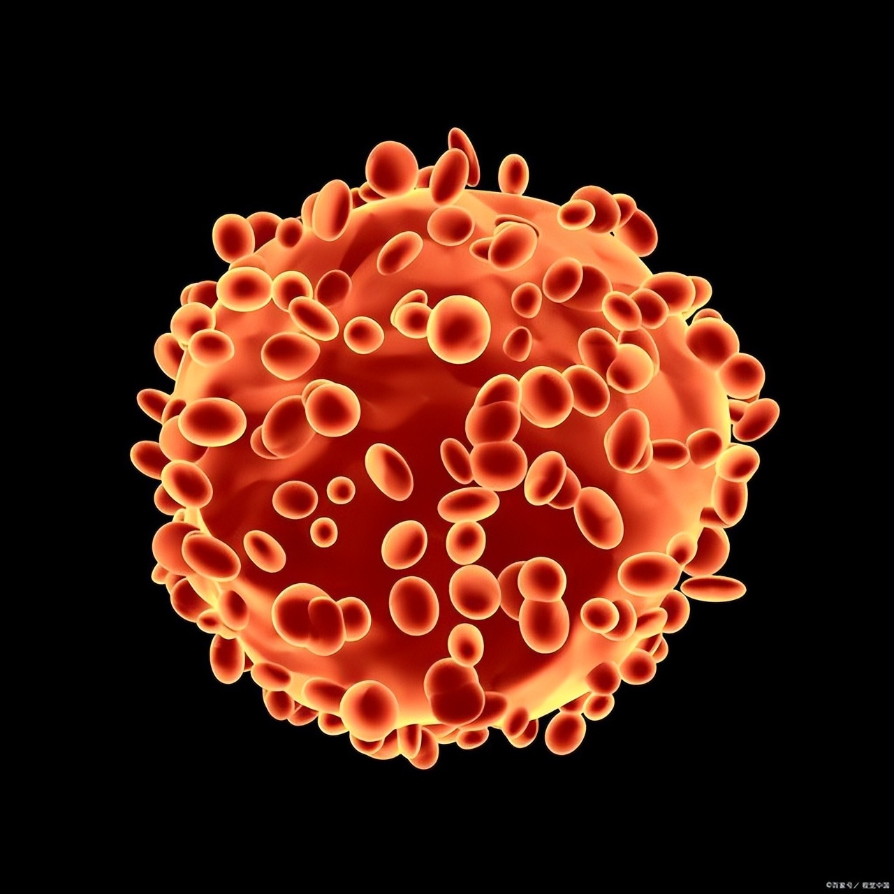 瞿治国,瞿治国医生治冠心病