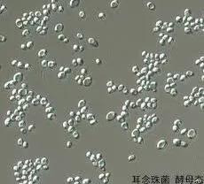 耳念珠菌是霉菌么,耳念珠菌是菌类的一种吗