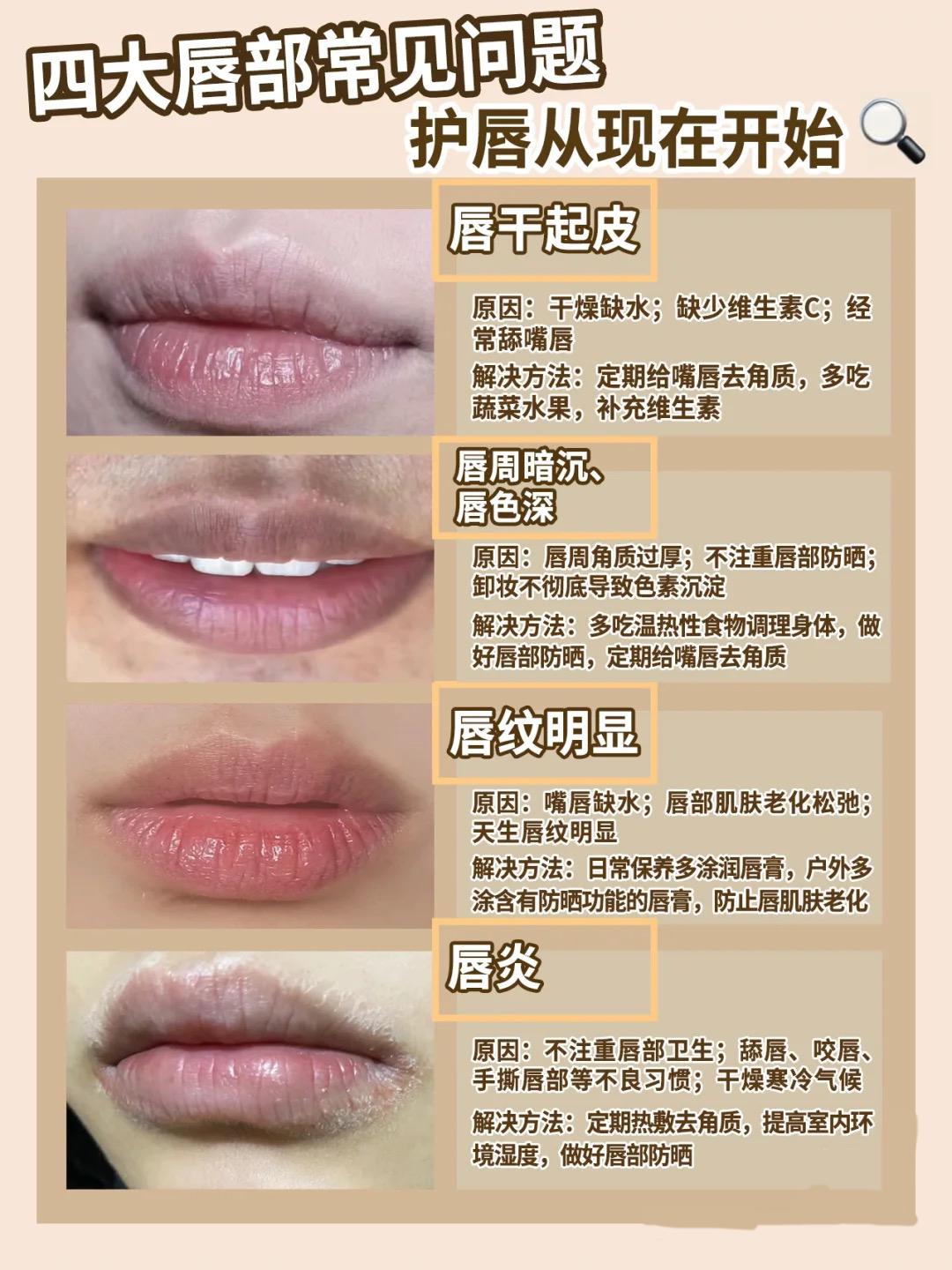 科普|常见唇部问题及科学护理方法