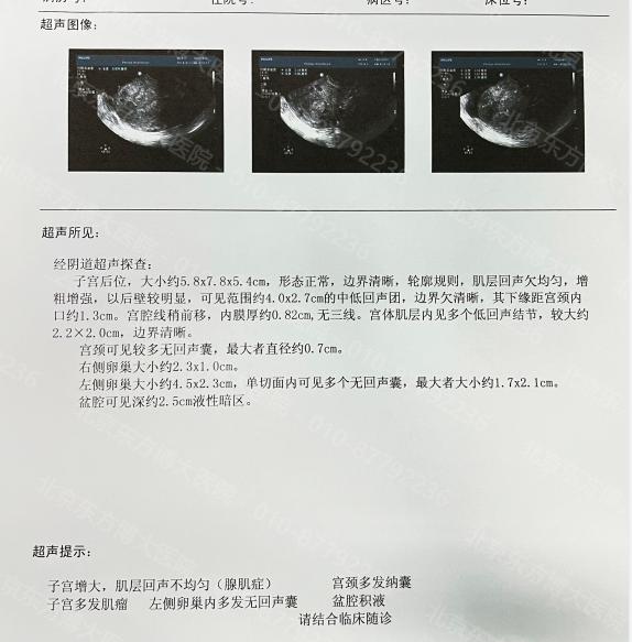 贵州治疗子宫腺肌症需要多少钱,南昌市子宫腺肌症最佳治疗方法