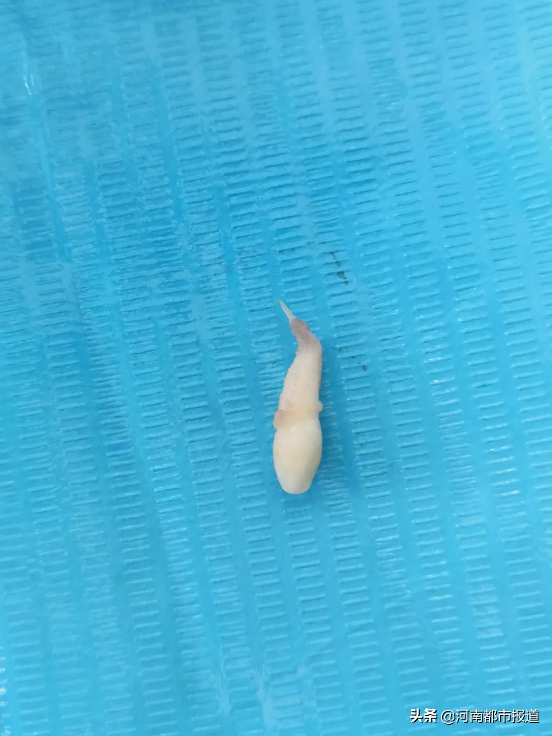 小孩刚长出来牙居然是尖的,孩子长出来的第一颗大牙