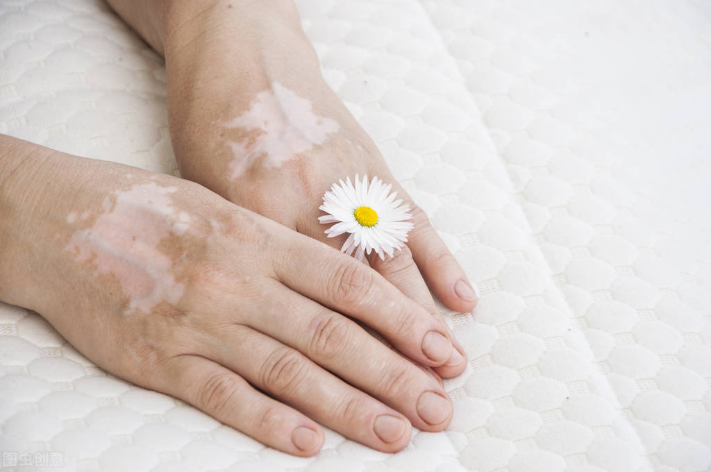 身体各处都有白点是什么东西,身体上有小白斑是什么原因