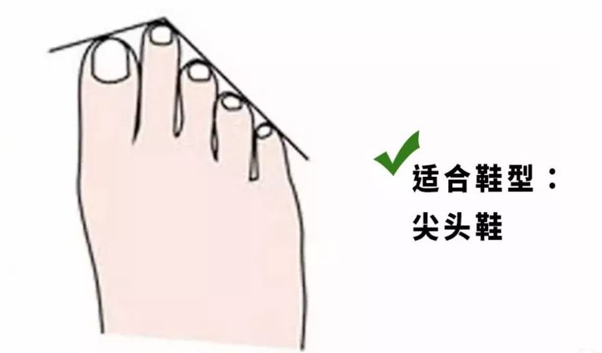 鞋子太紧穿不舒服怎么办,鞋子太松不跟脚