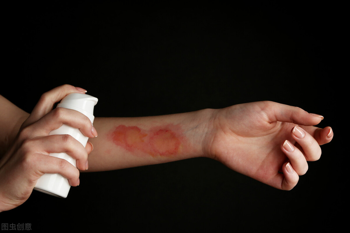 创可贴的基础知识,才知道创可贴还能有这样的好处